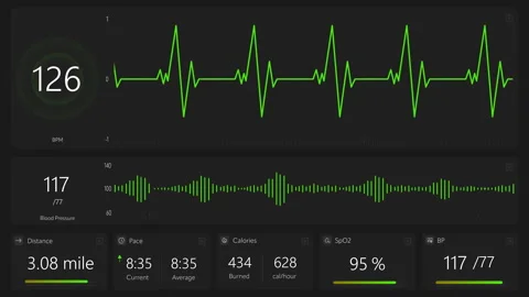 VFX Medical Interface Mockup With Pulse And Heartbeat Stock Footage 283753166