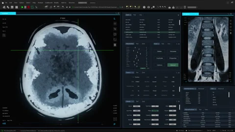 VFX Medical Xray Software Interface With... | Stock Video | Pond5