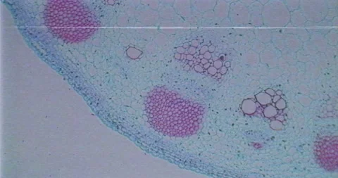VHS recording of plant stem with floating germs and bacteria under a microscope Stock Footage 198953705
