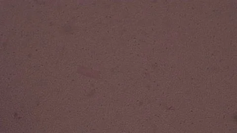Viability test in human semen. vitality living and non-living sperm cells Stock Footage 159904963