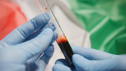 Vial of blood to be tested in a lab. Flag of Italy in background. Corona virus. Stock Footage 126901889