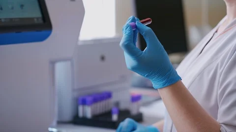 Vial of liquid in laboratory worker's hands. Medical worker mixing blood sample Stock Footage 120564021