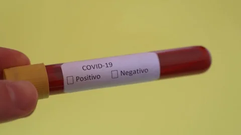 Vial with Sample blood test of Coronavirus COVID. Spanish Stock Footage 127242164