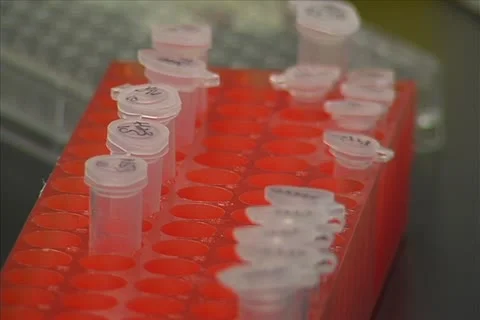 Vials in a container Stock Footage 11351191