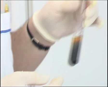 Vials With A Substance Vídeo Stock 1044023
