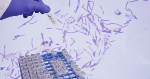 Vials of vaccines from a box Stock Footage 292912510