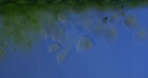 Vibrant vorticella colonies developing, spreading across microscopic landscape Stock Footage 313595085