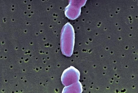  Vibrio parahaemolyticus This scanning electron micrograph (SEM) depicts a... Stock Photos
