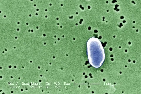  Vibrio parahaemolyticus This scanning electron micrograph (SEM) depicts a... Stock Photos