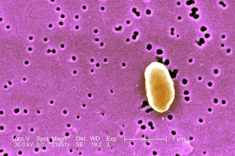  Vibrio parahaemolyticus This scanning electron micrograph (SEM) depicts a... Stock Photos