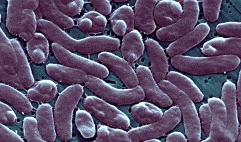  Vibrio vulnificus This scanning electron micrograph (SEM) depicts a group... Stock Photos