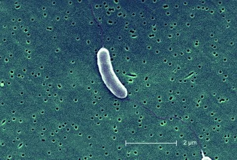 Vibrio vulnificus This scanning electron micrograph (SEM) depicts a flage... Stock Photos