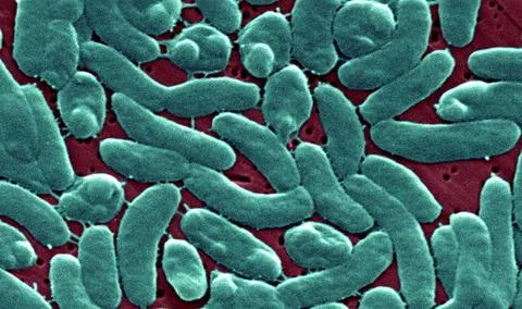  Vibrio vulnificus This scanning electron micrograph (SEM) depicts a group... Stock Photos