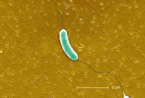  Vibrio vulnificus This scanning electron micrograph (SEM) depicts a flage... Stock Photos