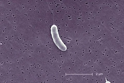  Vibrio vulnificus This scanning electron micrograph (SEM) depicts a flage... Stock Photos
