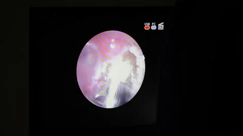 Video from a camera inside a person Stock Footage 155177716