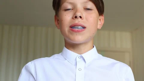 The video captures a close-up of him placing the aligner into his mouth Video stock 287316146