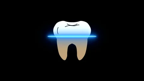 Video illustration with the process of cleaning and treating a tooth from plaque Stock Footage 148090292