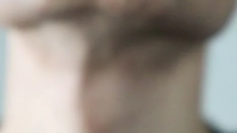 Video of a Japanese man whose skin became rough after laser hair removal Stock Footage 326087163