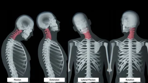 Video of Neck movements include flexion, extension, lateral flexion, and Stockbeeldmateriaal 335009504
