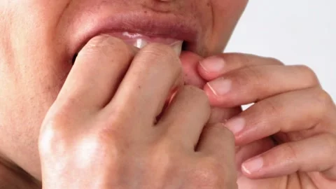 Video of a person correcting their teeth with a mouthpiece Video stock 323494106