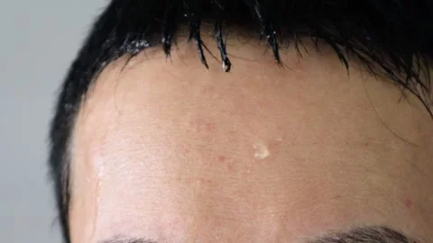 Video of a person sweating profusely and cooling their head with an ice pack Stock-Footage 323502217