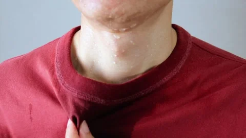 Video of a person sweating profusely Stock Footage 323503026