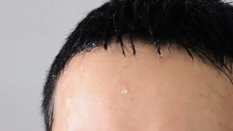 Video of a person's head sweating profusely Stock Footage 323502694