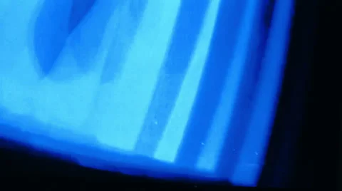 Video Recursions-3 Stock Footage 33791906