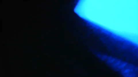 Video Recursions-5 Stock Footage 33796039