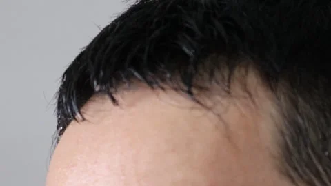 Video of a sweaty person's head Stock Footage 323502654