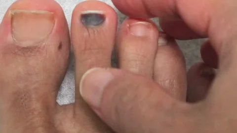 Video of touching injured toe Video stock 323493329