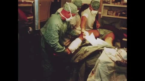 VIETNAM - 1966 - Medics put a plaster cast on a wounded US Marine's leg in a Stock Footage 340577995