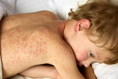 View from above of sad boy lying on bed courageously enduring unpleasant illness Stock Photos
