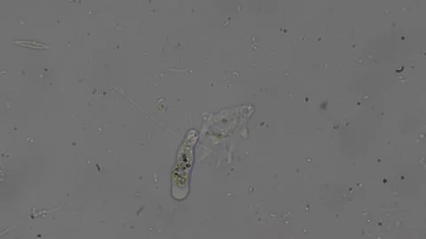 View of amoeba under magnification in a water sample, timelapse reveals com.. Video stock 308784533