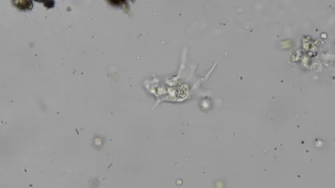 View of amoeba under magnification in a water sample, timelapse reveals com.. Stock Footage 309513072