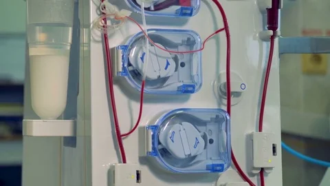 A view on a dialysis machine with a screen from bottom to top. Stock Footage 84088677