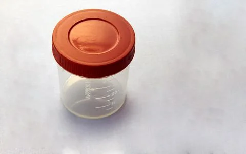 View of  empty plastic container for taking urine samples of patient in patho Stock Photos