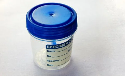 View of  empty plastic container for taking stool or feces samples of patient Foto stock