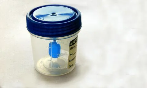 View of  empty plastic container for taking stool or feces samples of patient 스톡 사진