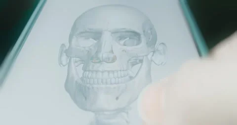 View of the facial bones of the human head Stock Footage 313838630