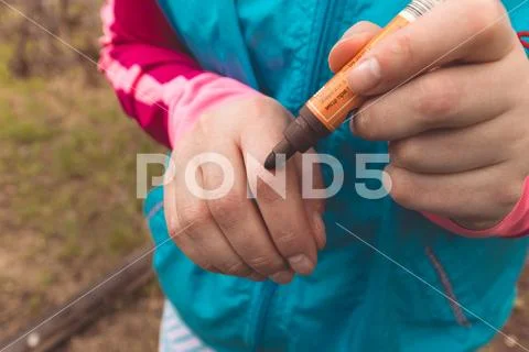 View of finger on right human hand is cut hurt and bleeding with bright red b Stock Photos