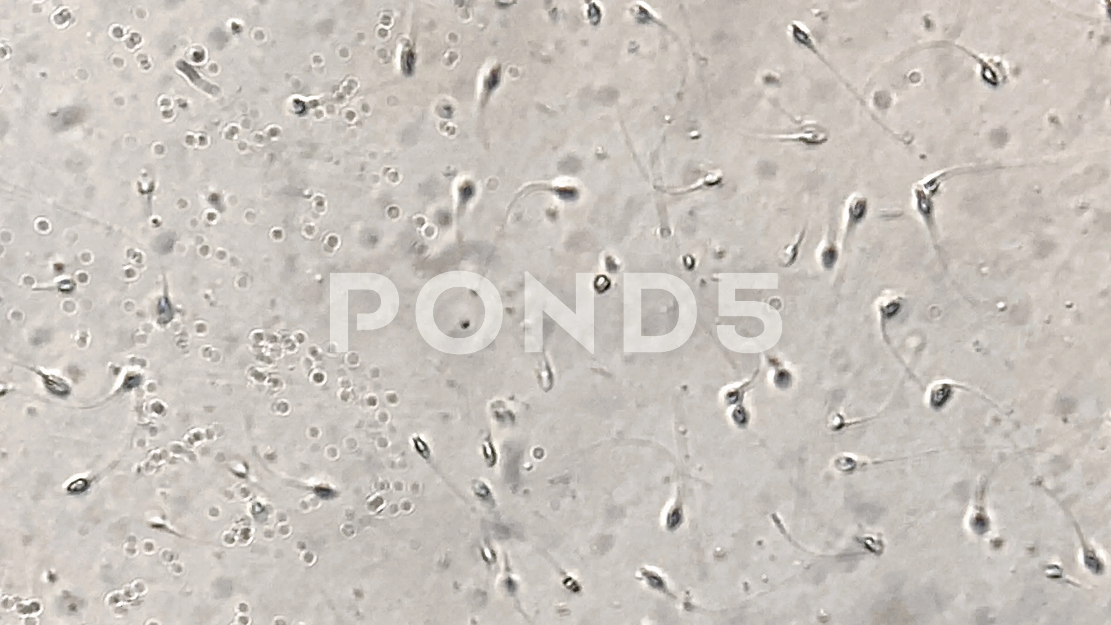 Semen Under Microscope Semen Under Microscope