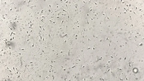 View at human sperm under microscope in lab Stock Footage 114192446