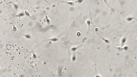 View at human sperm under microscope in lab Video stock 114192462