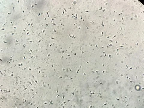 View at human sperm under microscope in lab Stock Photos