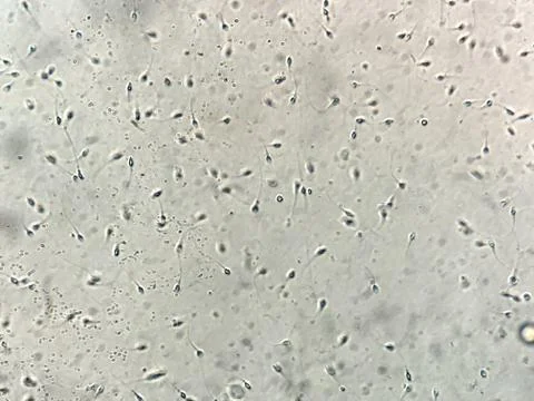 View at human sperm under microscope in lab Stock Photos