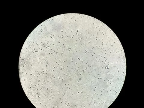 View at human sperm under microscope in lab Stock Photos