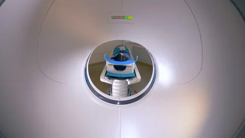 A view from inside of a working CT machine. 스톡 동영상 86389572