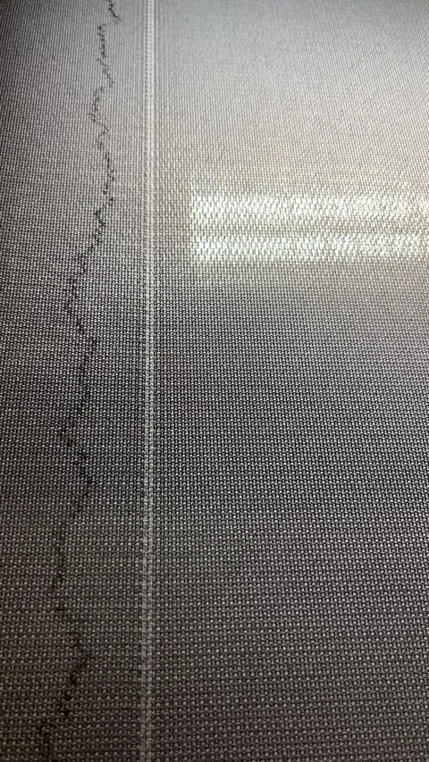 A view of knitting defects on the fabric of a thread break Stock Footage 264948844